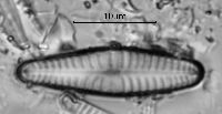 Gomphonema innocens image