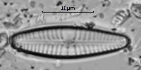 Image of Gomphonema innocens