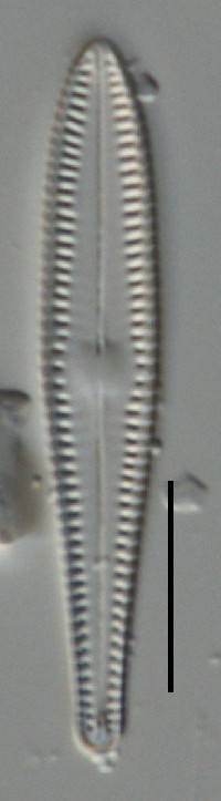 Image of Gomphosphenia lingulatiformis