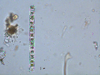Hyalotheca mucosa image
