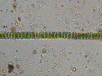Image of Hyalotheca dissiliens