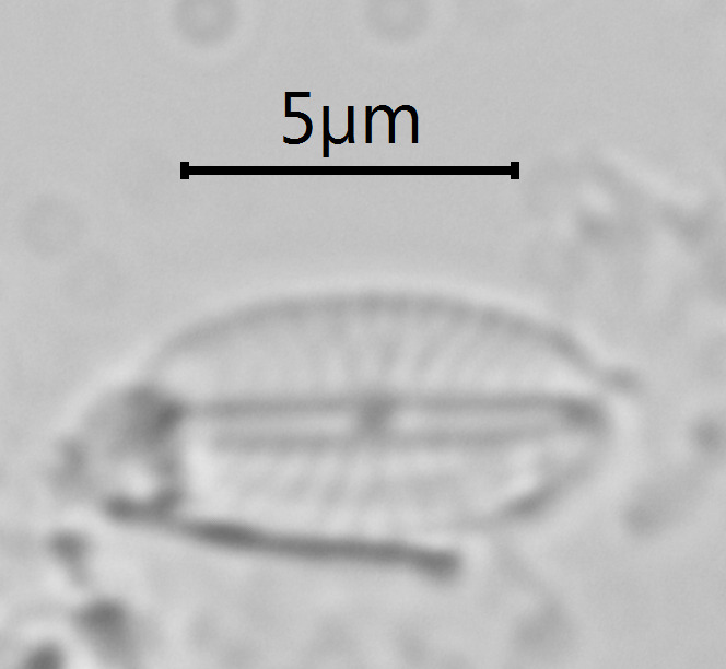 Mayamaea excelsa image