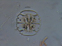 Micrasterias truncata var. pusilla image