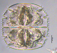 Micrasterias truncata var. pusilla image