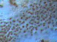 Microcystis aeruginosa image