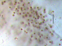 Microcystis aeruginosa image