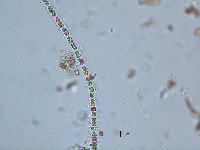 Microspora tumidula image