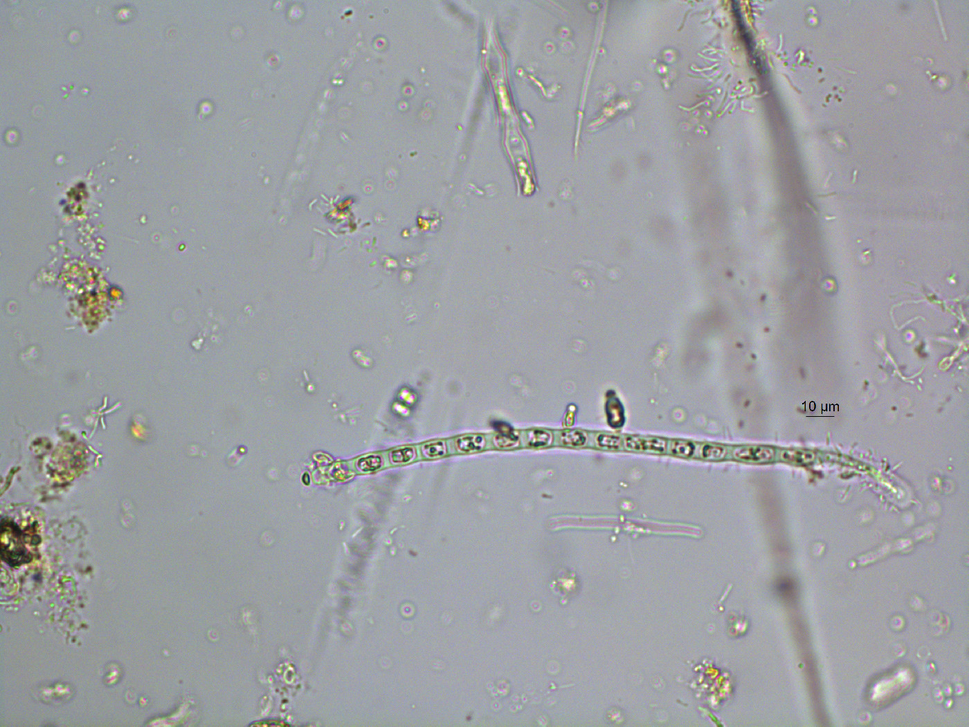 Microspora image