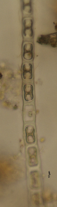 Microspora tumidula image