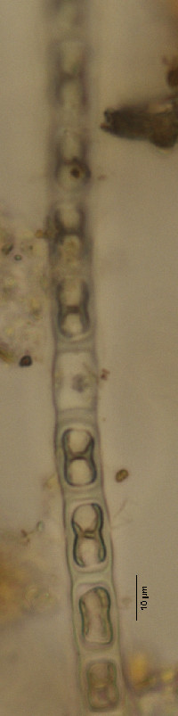 Image of Microspora tumidula