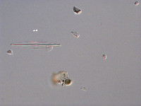 Navicula cryptocephala image
