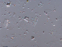 Navicula microcari image