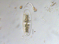 Netrium digitus image