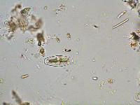 Netrium digitus image