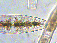 Netrium digitus image