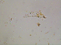 Oedogonium reinschii image