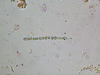 Image of Oedogonium reinschii