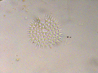 Pediastrum duplex image