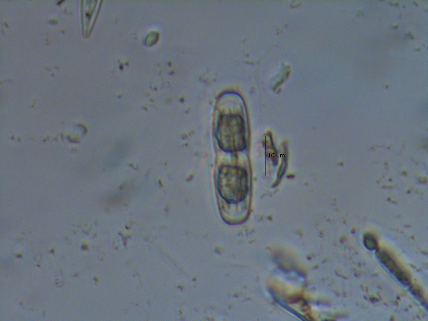 Penium margaritaceum image