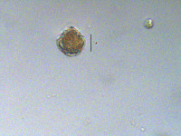 Peridinium aciculiferum image