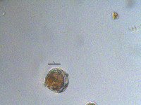 Peridinium aciculiferum image