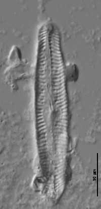 Pinnularia microstauron image