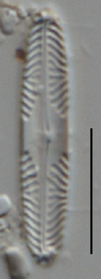 Image of Pinnularia acidophila