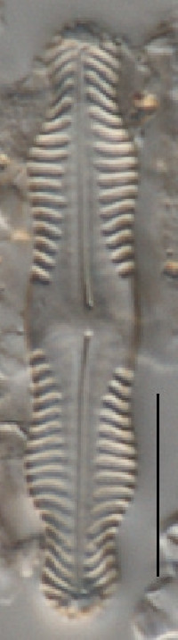 Image of Pinnularia angusta
