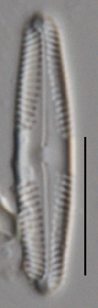 Image of Pinnularia appendiculata