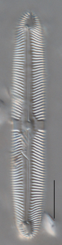 Image of Pinnularia stomatophora