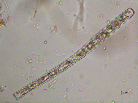 Image of Pleurotaenium coronatum