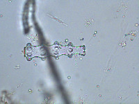 Image of Pleurotaenium nodosum