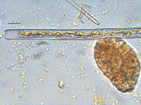 Image of Haplotaenium minutum