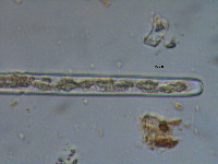 Pleurotaenium minutum var. cylindricum image