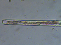 Pleurotaenium minutum var. cylindricum image