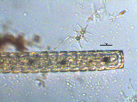 Image of Pleurotaenium verrucosum