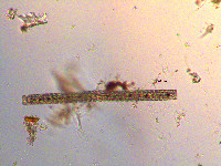 Pleurotaenium verrucosum image