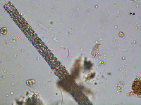 Pleurotaenium verrucosum image