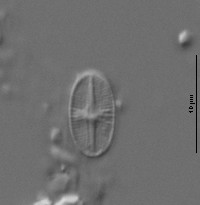 Psammothidium subatomoides image