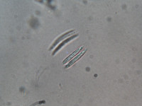 Image of Quadrigula closterioides