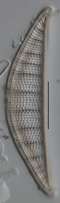 Rhopalodia operculata image