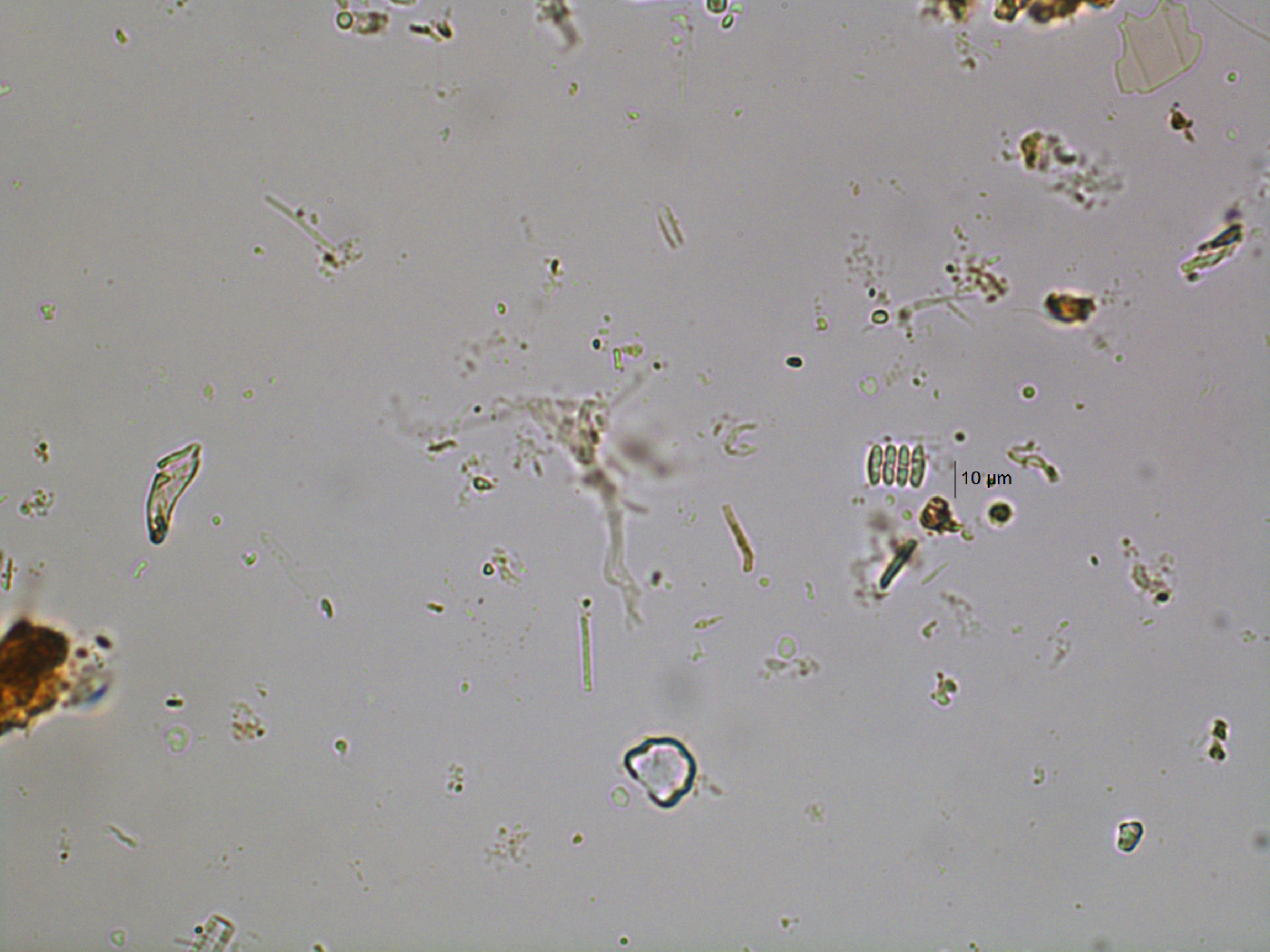 Scenedesmus microspina image