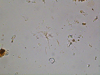 Image of Scenedesmus microspina