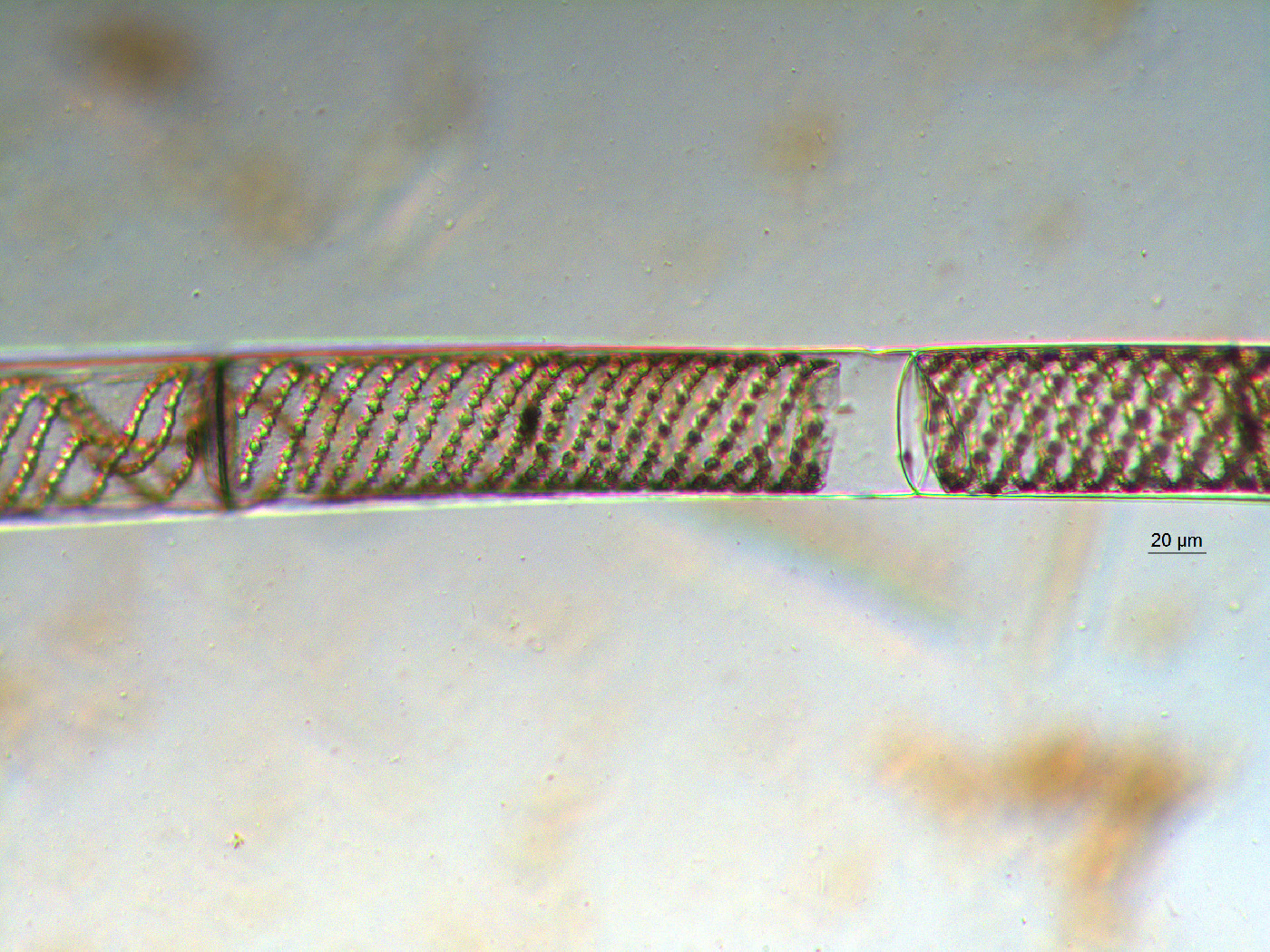 Spirogyra image