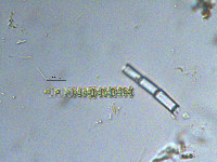 Image of Spondylosium pulchrum