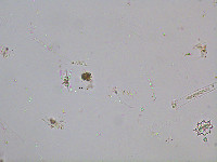 Image of Staurastrum connatum