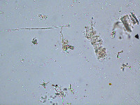 Image of Staurastrum inflexum