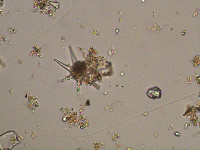 Staurastrum radians image
