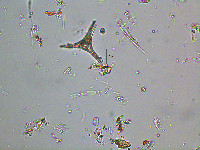 Image of Staurastrum anatinum