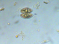 Staurastrum lapponicum image